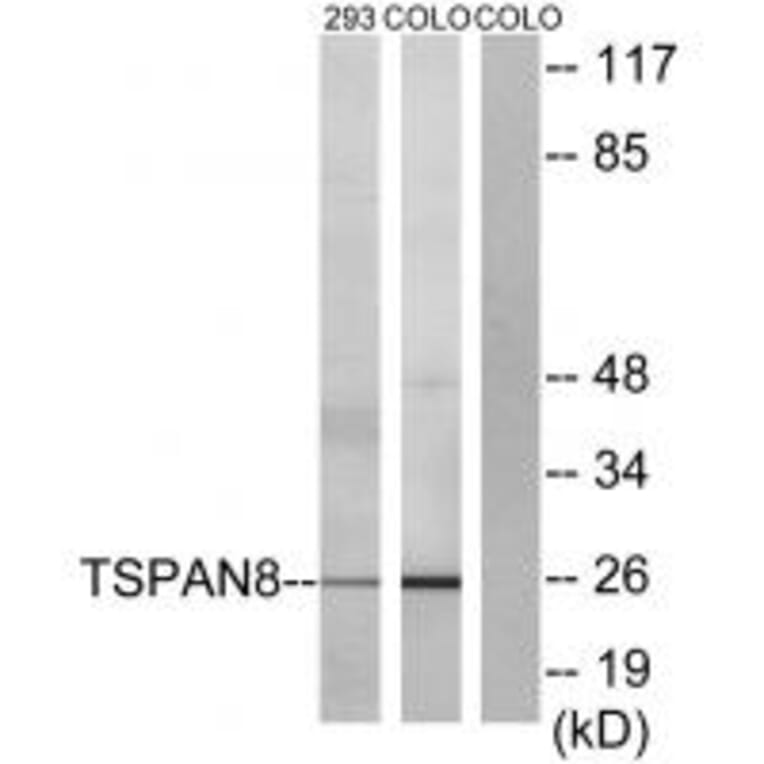 Western blot - TSPAN8 Antibody from Signalway Antibody (33705) - Antibodies.com