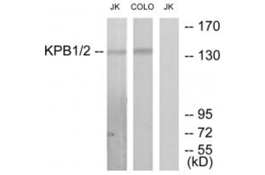 Western blot - KPB1/2 Antibody from Signalway Antibody (33776) - Antibodies.com