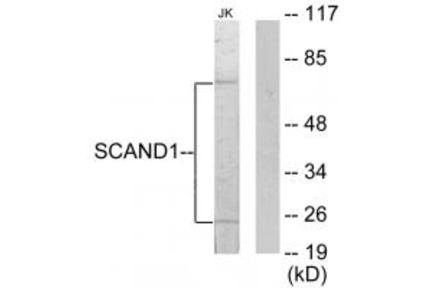 Western blot - SCAND1 Antibody from Signalway Antibody (33828) - Antibodies.com
