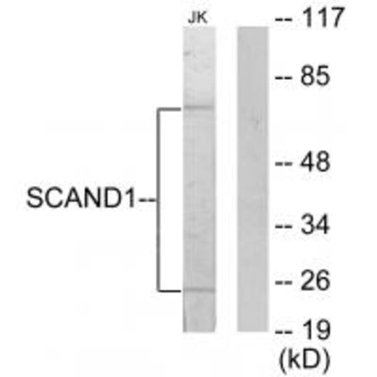 Western blot - SCAND1 Antibody from Signalway Antibody (33828) - Antibodies.com