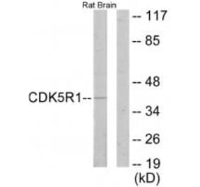 Western blot - CDK5R1 Antibody from Signalway Antibody (33891) - Antibodies.com