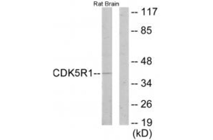 Western blot - CDK5R1 Antibody from Signalway Antibody (33891) - Antibodies.com