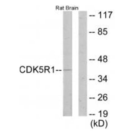 Western blot - CDK5R1 Antibody from Signalway Antibody (33891) - Antibodies.com