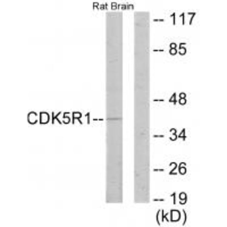 Western blot - CDK5R1 Antibody from Signalway Antibody (33891) - Antibodies.com