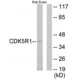 Western blot - CDK5R1 Antibody from Signalway Antibody (33891) - Antibodies.com