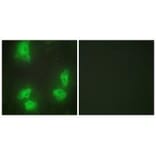 Immunofluorescence - CDK5R1 Antibody from Signalway Antibody (33891) - Antibodies.com