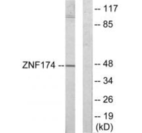 Western blot - ZNF174 Antibody from Signalway Antibody (33904) - Antibodies.com