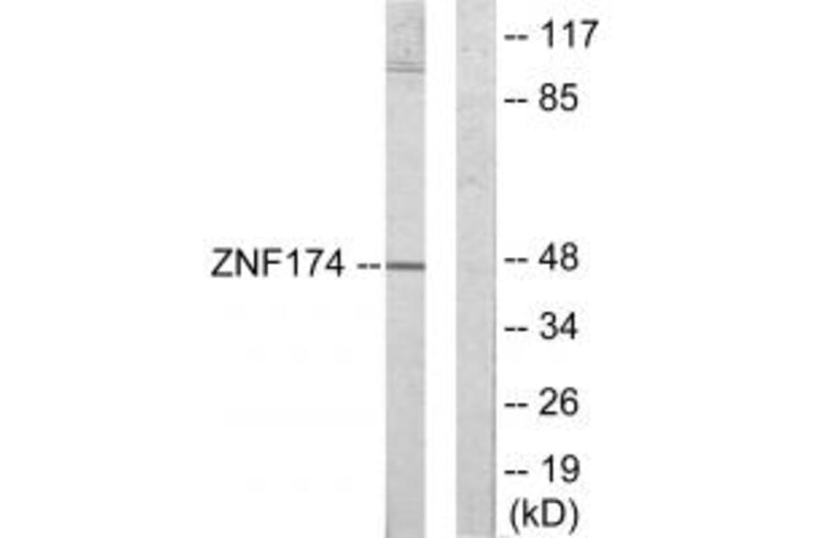 Western blot - ZNF174 Antibody from Signalway Antibody (33904) - Antibodies.com