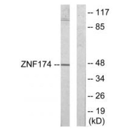 Western blot - ZNF174 Antibody from Signalway Antibody (33904) - Antibodies.com