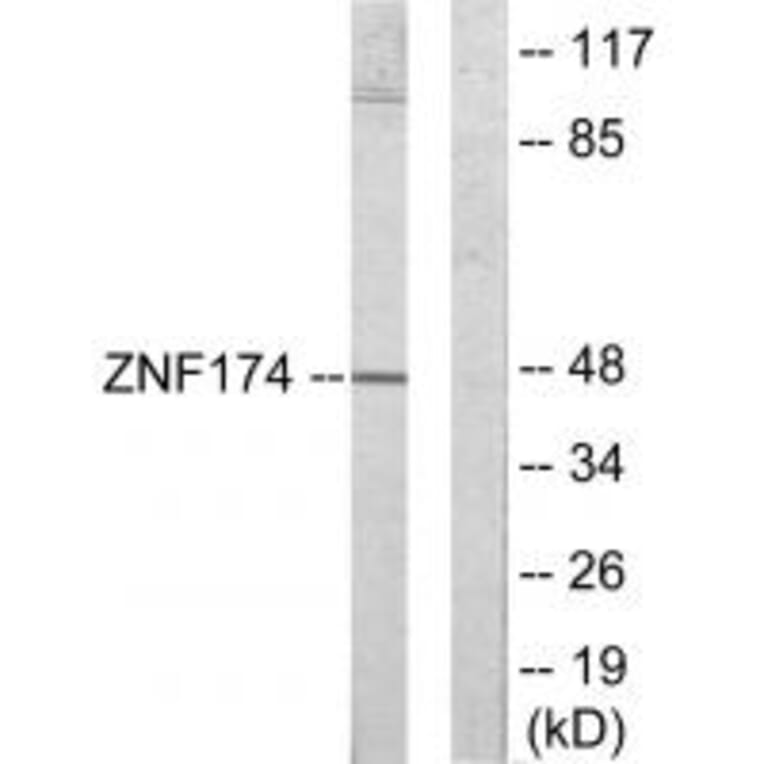 Western blot - ZNF174 Antibody from Signalway Antibody (33904) - Antibodies.com