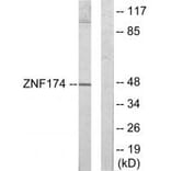 Western blot - ZNF174 Antibody from Signalway Antibody (33904) - Antibodies.com