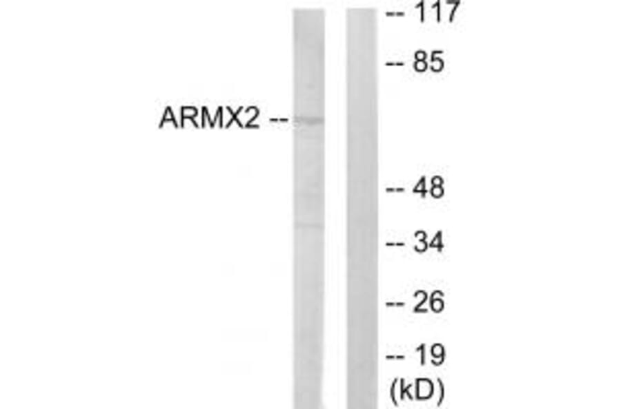 Western blot - ARMX2 Antibody from Signalway Antibody (33943) - Antibodies.com