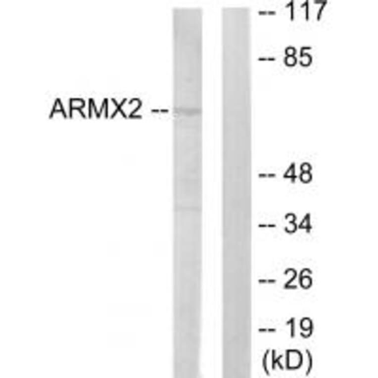 Western blot - ARMX2 Antibody from Signalway Antibody (33943) - Antibodies.com