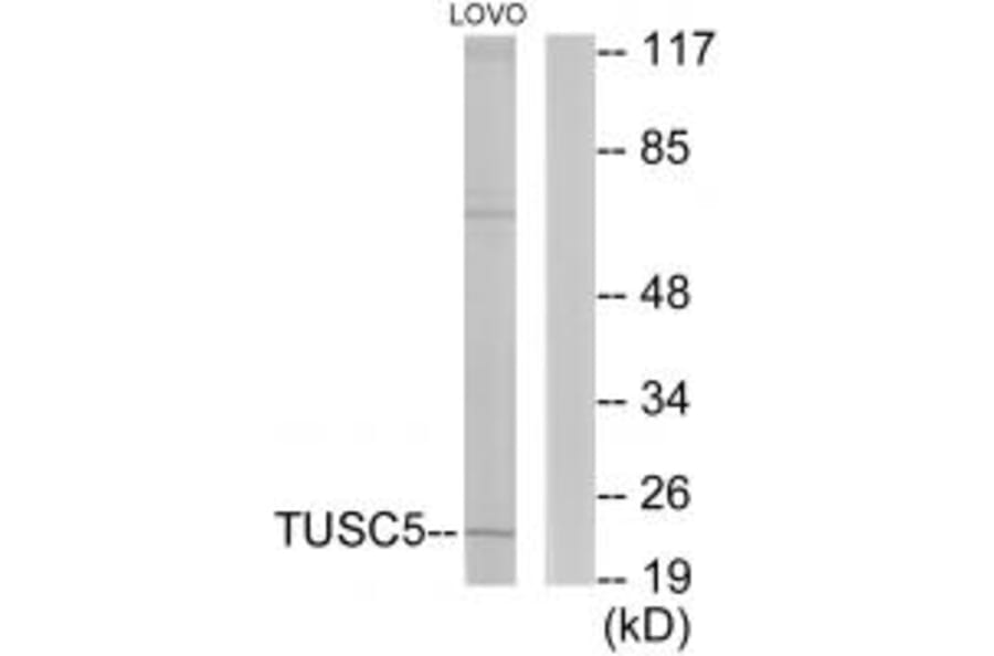 Western blot - TUSC5 Antibody from Signalway Antibody (33962) - Antibodies.com