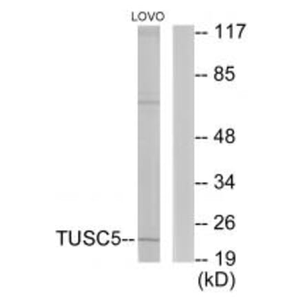 Western blot - TUSC5 Antibody from Signalway Antibody (33962) - Antibodies.com