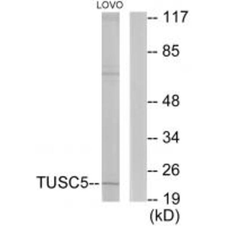 Western blot - TUSC5 Antibody from Signalway Antibody (33962) - Antibodies.com