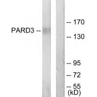 Western blot analysis of extracts from COLO205 cells, using PARD3 antibody #33992.