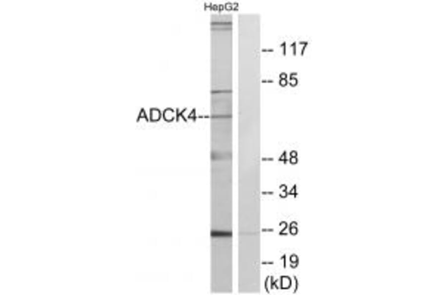 Western blot - ADCK4 Antibody from Signalway Antibody (34026) - Antibodies.com