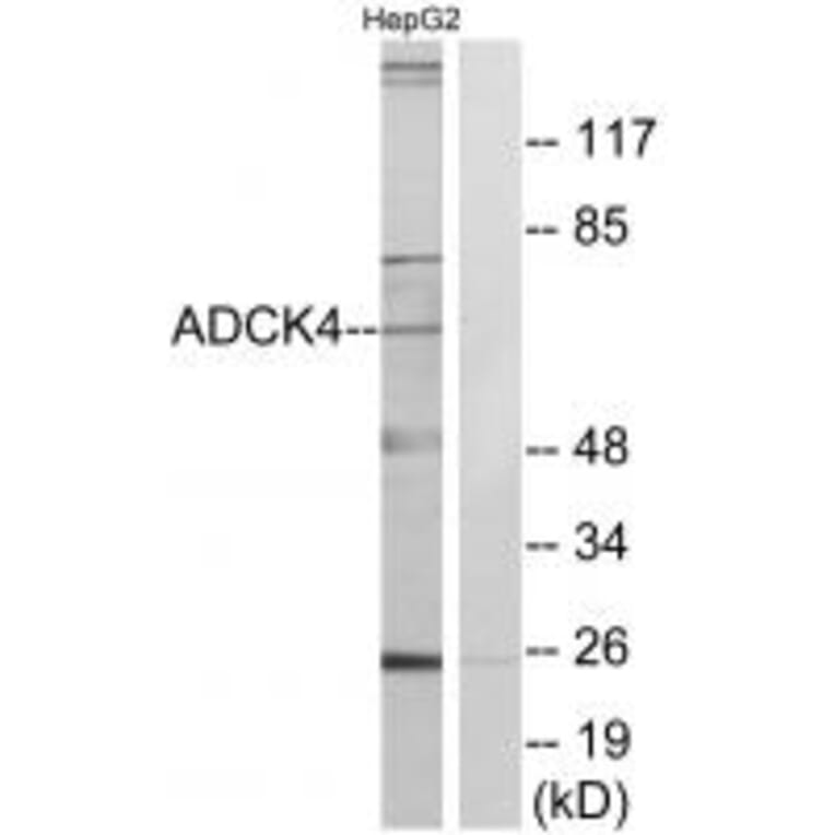 Western blot - ADCK4 Antibody from Signalway Antibody (34026) - Antibodies.com