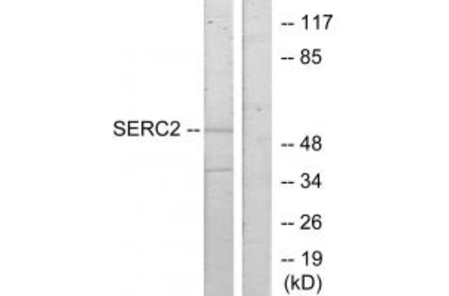 Western blot - SERC2 Antibody from Signalway Antibody (34036) - Antibodies.com