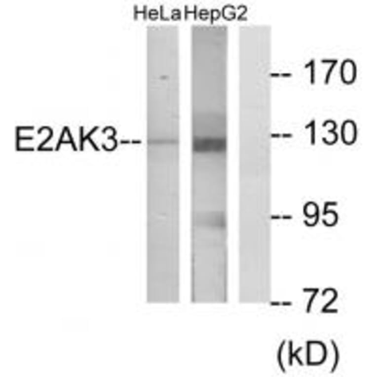 Western blot - E2AK3 Antibody from Signalway Antibody (34086) - Antibodies.com