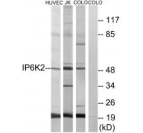 Western blot - IP6K2 Antibody from Signalway Antibody (34104) - Antibodies.com