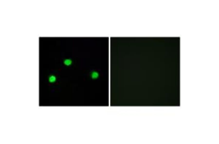Immunofluorescence - IP6K2 Antibody from Signalway Antibody (34104) - Antibodies.com