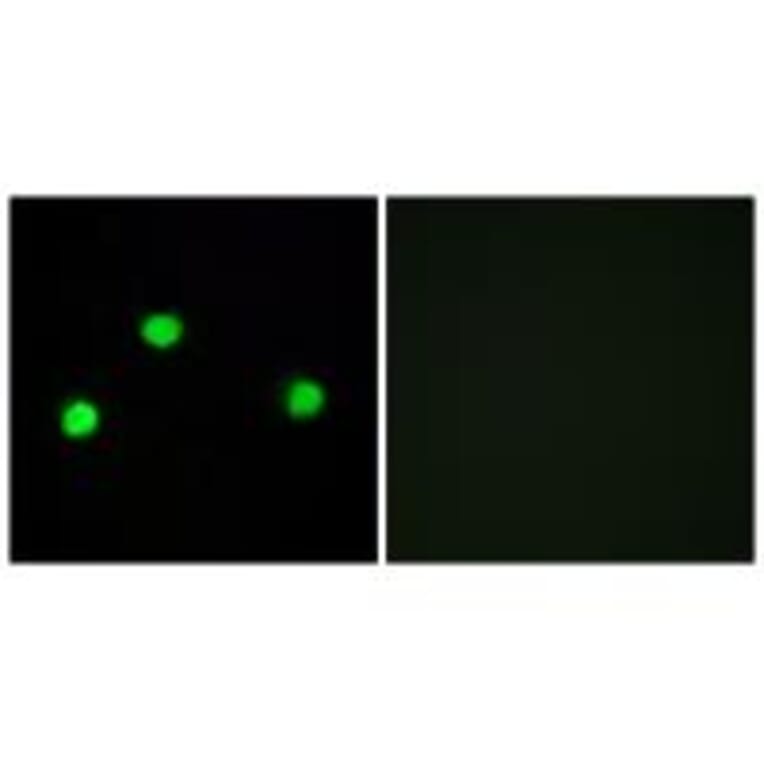 Immunofluorescence - IP6K2 Antibody from Signalway Antibody (34104) - Antibodies.com