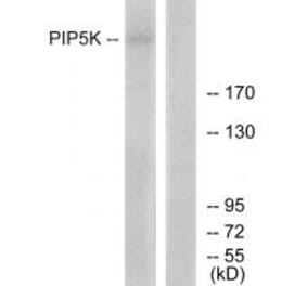 Western blot - PIP5K Antibody from Signalway Antibody (34128) - Antibodies.com