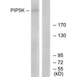 Western blot - PIP5K Antibody from Signalway Antibody (34128) - Antibodies.com