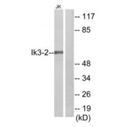 Western blot - Ik3-2 Antibody from Signalway Antibody (34173) - Antibodies.com