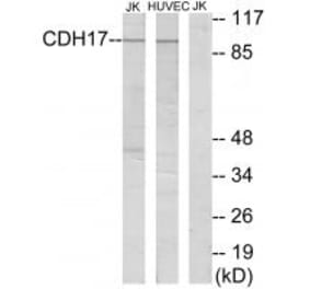 Western blot - CDH17 Antibody from Signalway Antibody (34177) - Antibodies.com