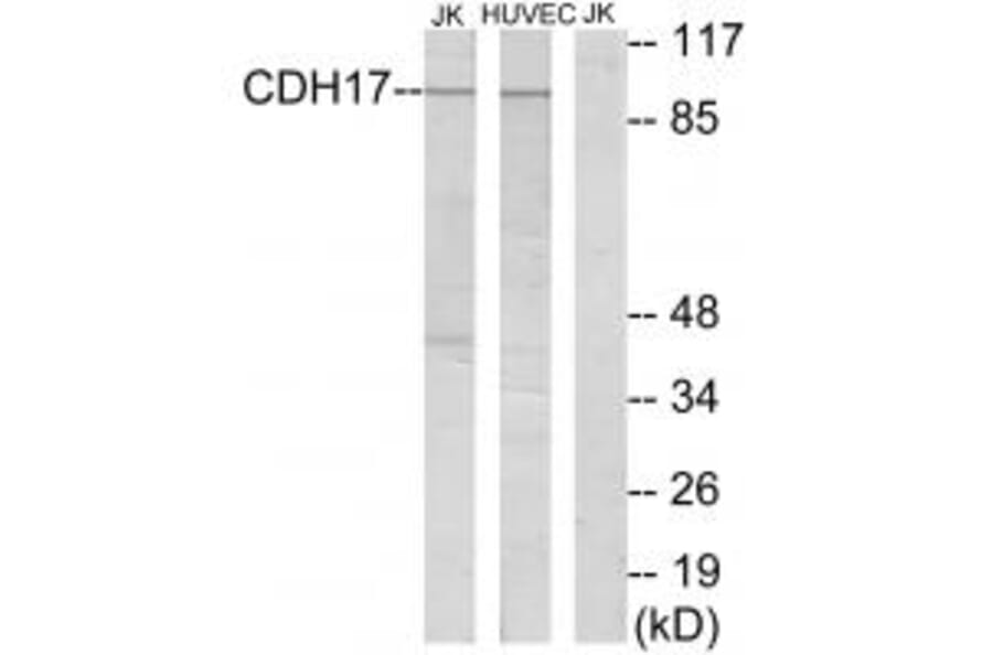 Western blot - CDH17 Antibody from Signalway Antibody (34177) - Antibodies.com