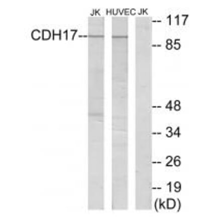 Western blot - CDH17 Antibody from Signalway Antibody (34177) - Antibodies.com
