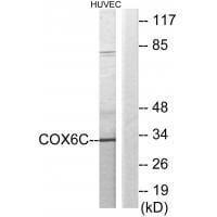 Western blot analysis of extracts from HUVEC cells, using COX6C antibody #34225.