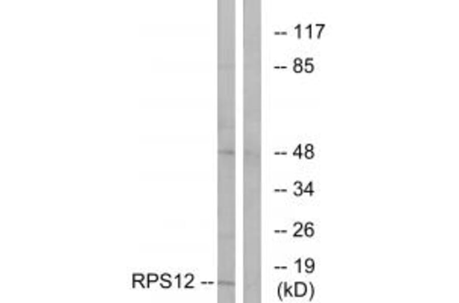 Western blot - RPS12 Antibody from Signalway Antibody (34329) - Antibodies.com