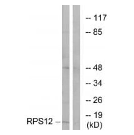 Western blot - RPS12 Antibody from Signalway Antibody (34329) - Antibodies.com