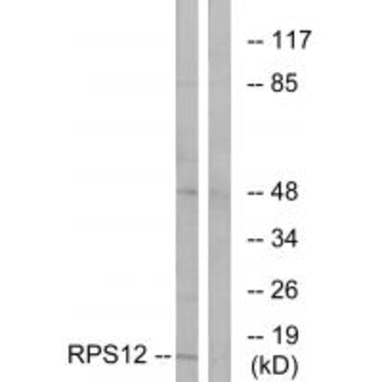 Western blot - RPS12 Antibody from Signalway Antibody (34329) - Antibodies.com