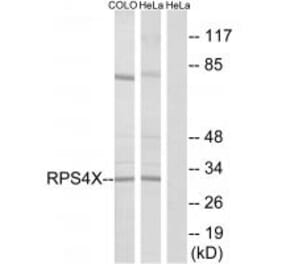 Western blot - RPS4X Antibody from Signalway Antibody (34339) - Antibodies.com