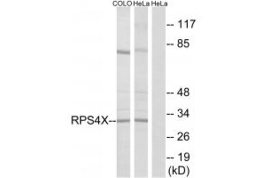 Western blot - RPS4X Antibody from Signalway Antibody (34339) - Antibodies.com