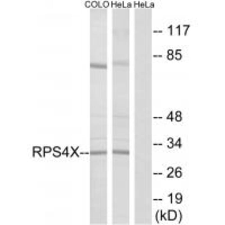 Western blot - RPS4X Antibody from Signalway Antibody (34339) - Antibodies.com