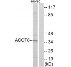 Western blot - ACOT8 Antibody from Signalway Antibody (34383) - Antibodies.com