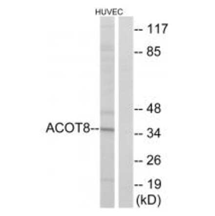 Western blot - ACOT8 Antibody from Signalway Antibody (34383) - Antibodies.com