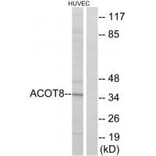 Western blot - ACOT8 Antibody from Signalway Antibody (34383) - Antibodies.com