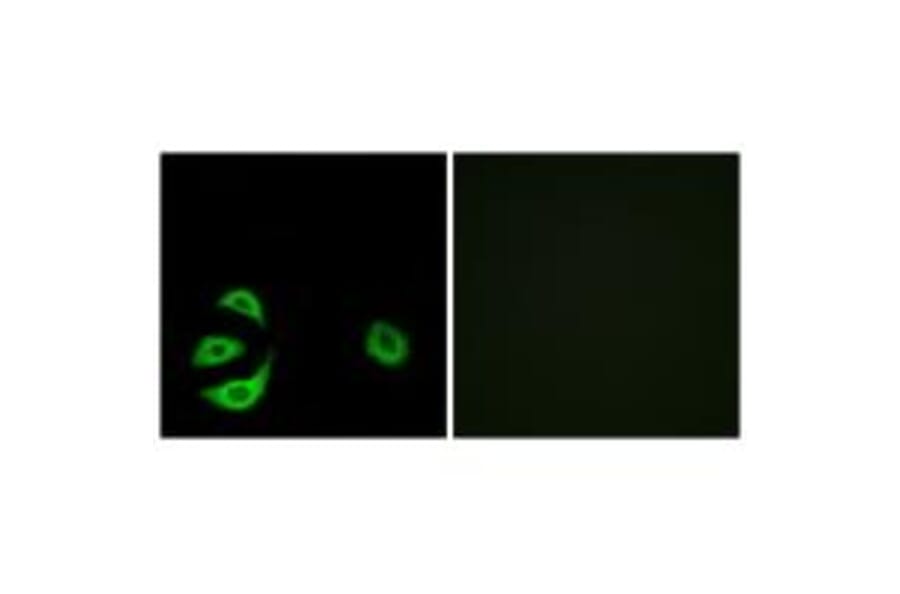 Immunofluorescence - ACOT8 Antibody from Signalway Antibody (34383) - Antibodies.com