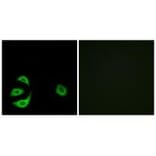 Immunofluorescence - ACOT8 Antibody from Signalway Antibody (34383) - Antibodies.com