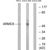 Western blot analysis of extracts from HeLa cells and COLO cells, using ARMC6 antibody #34439.
