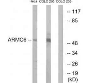 Western blot - ARMC6 Antibody from Signalway Antibody (34439) - Antibodies.com