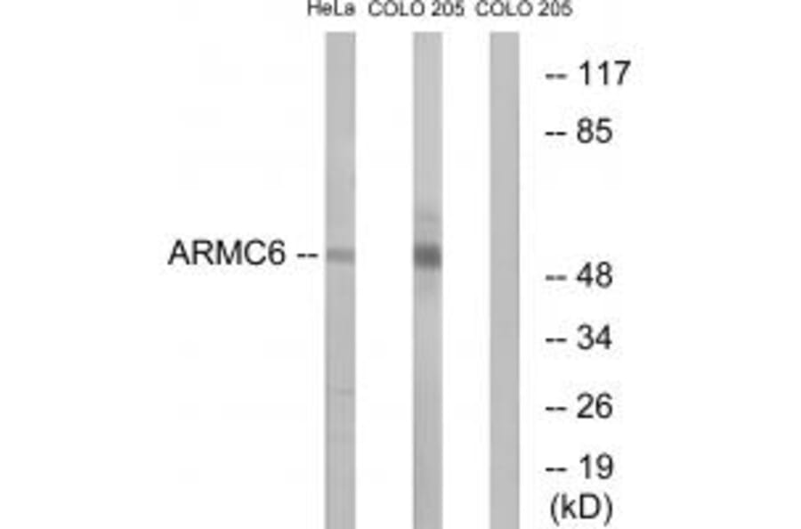 Western blot - ARMC6 Antibody from Signalway Antibody (34439) - Antibodies.com