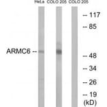 Western blot - ARMC6 Antibody from Signalway Antibody (34439) - Antibodies.com